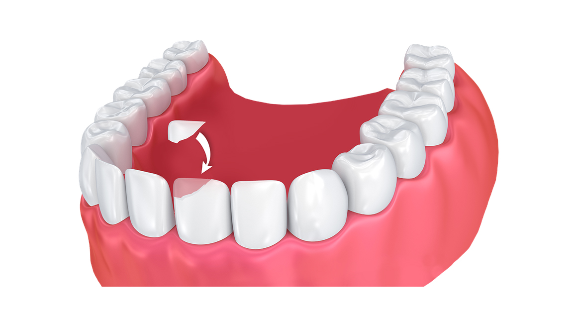 Dentures1150.jpg